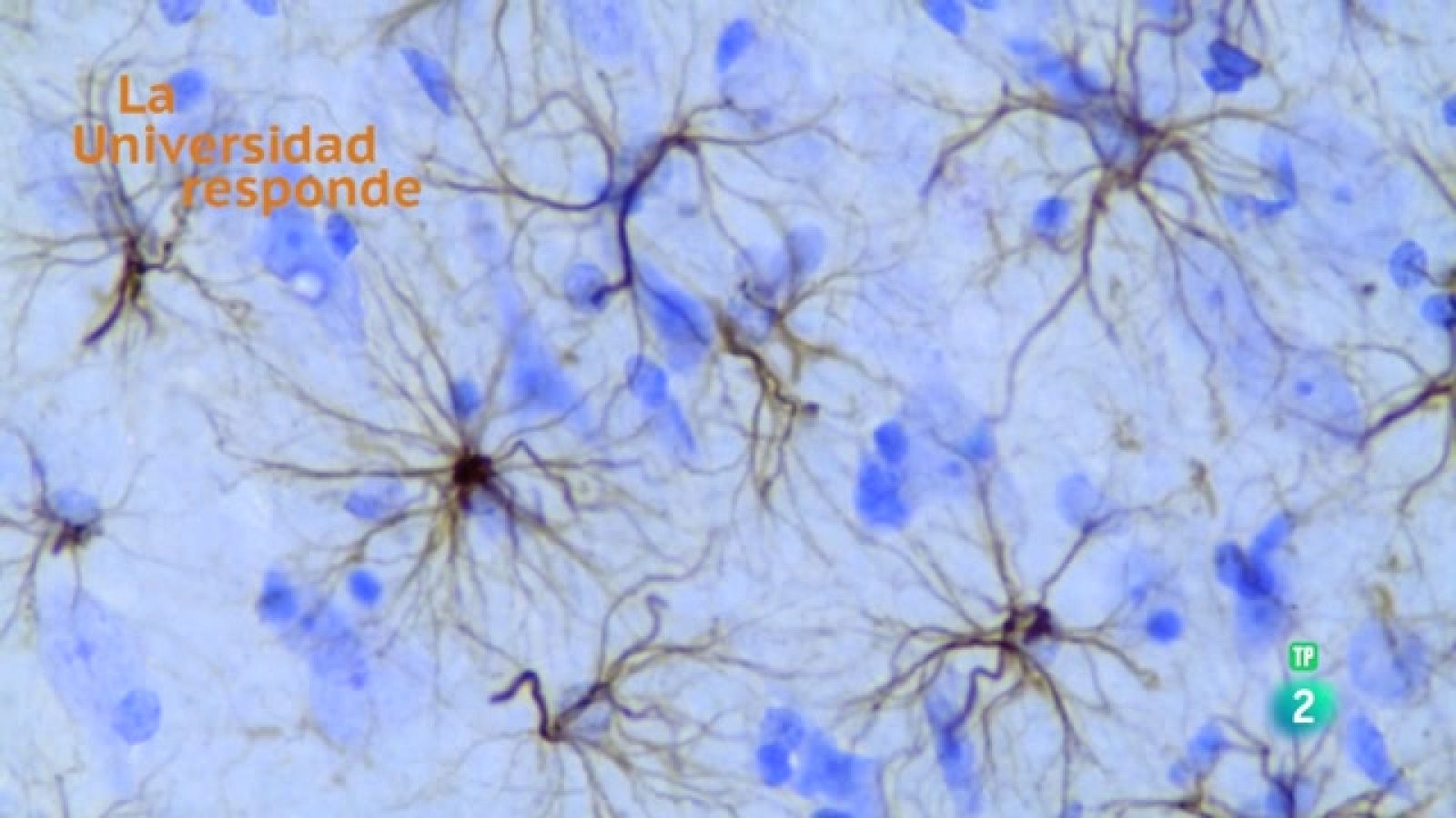 La aventura del saber - ¿Qué son las células gliales? - ver ahora