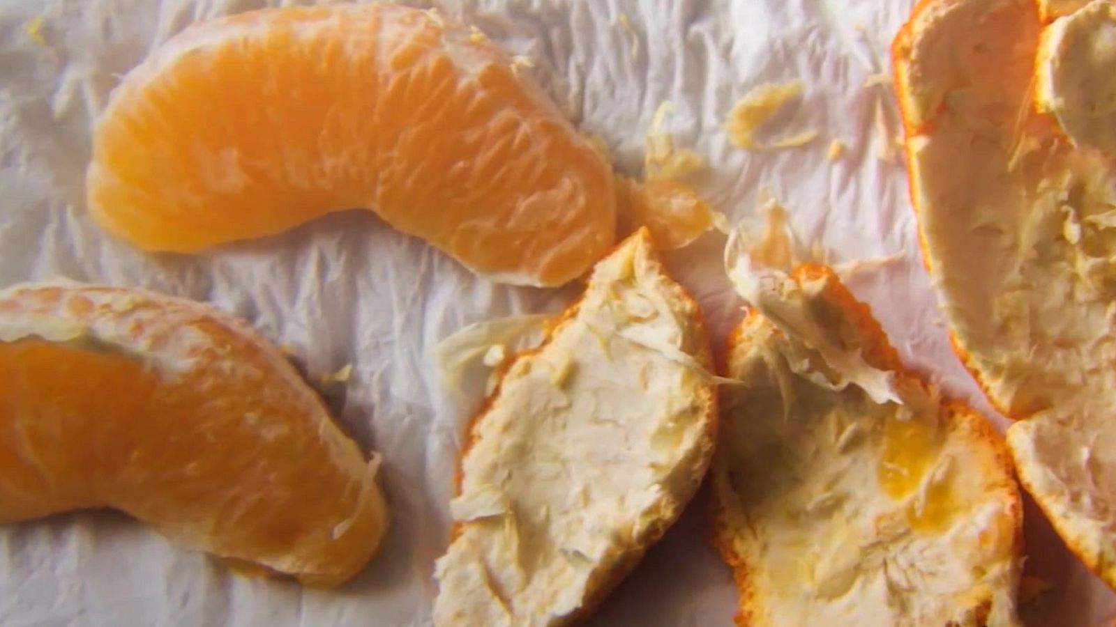 Fotografía | Pepe Guinea: el día a día de un enfermo de cáncer | Ver