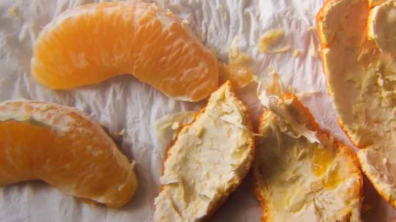 Fotografía | Pepe Guinea: el día a día de un enfermo de cáncer | Ver