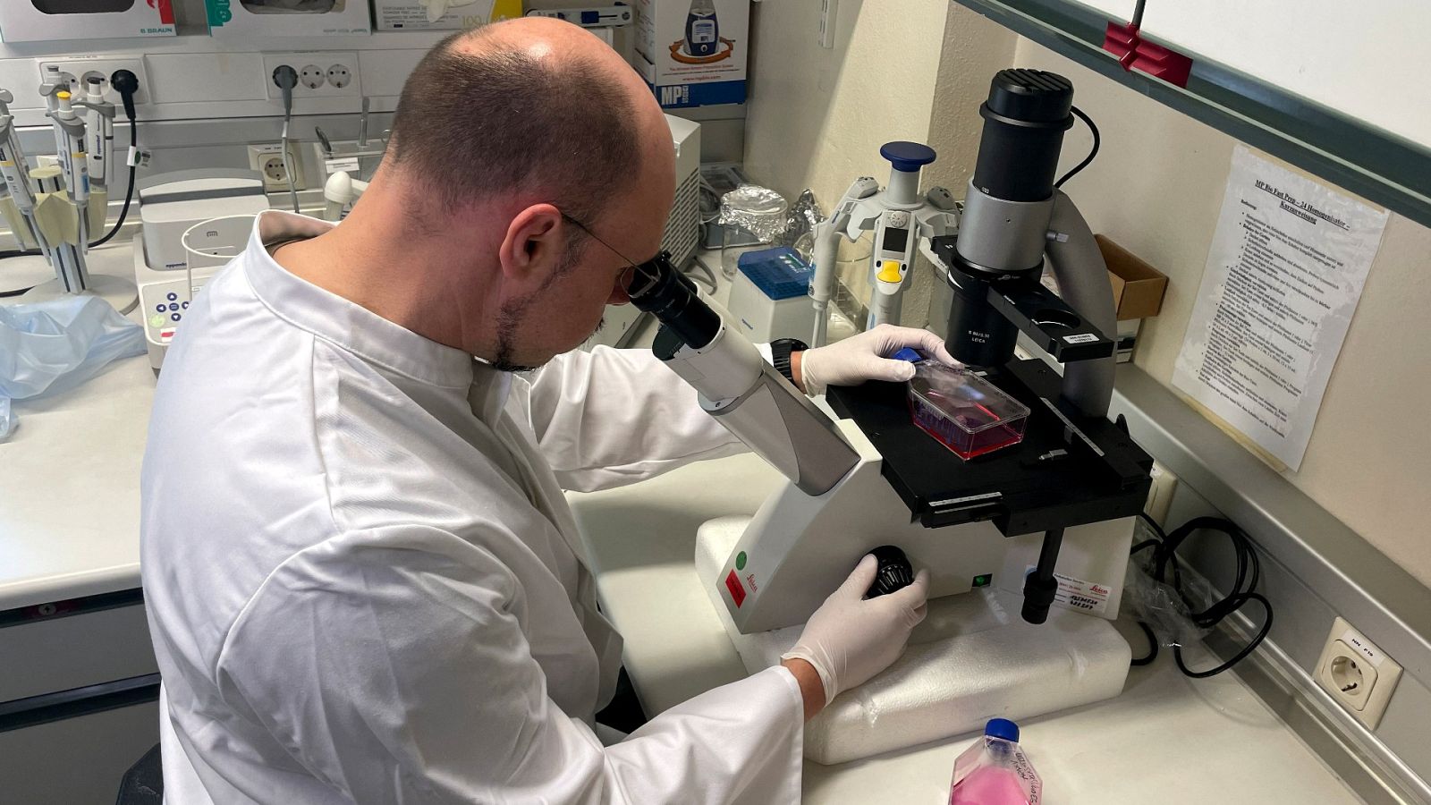 Madrid confirma siete casos de viruela del mono y otros 24 sospechosos | Ver