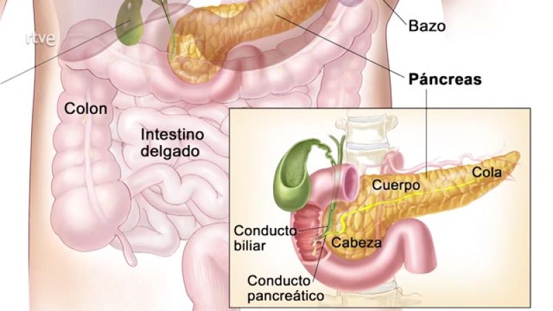 La aventura del saber - Universo sostenible: ¿Es la diabetes una enfermedad en auge?