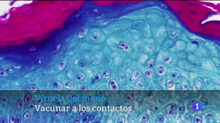 Telecanarias - Telecanarias - 28/05/2022