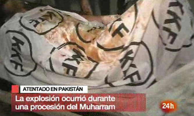  - Atentado en Karachi