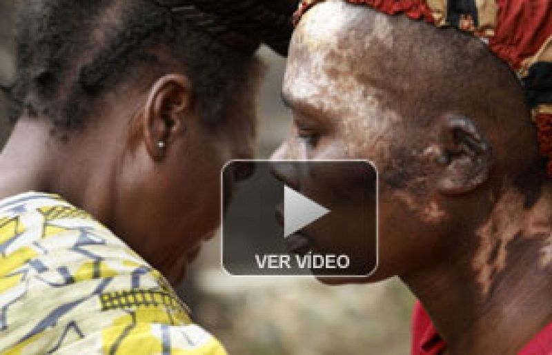 Las heridas de Françoise | Ver