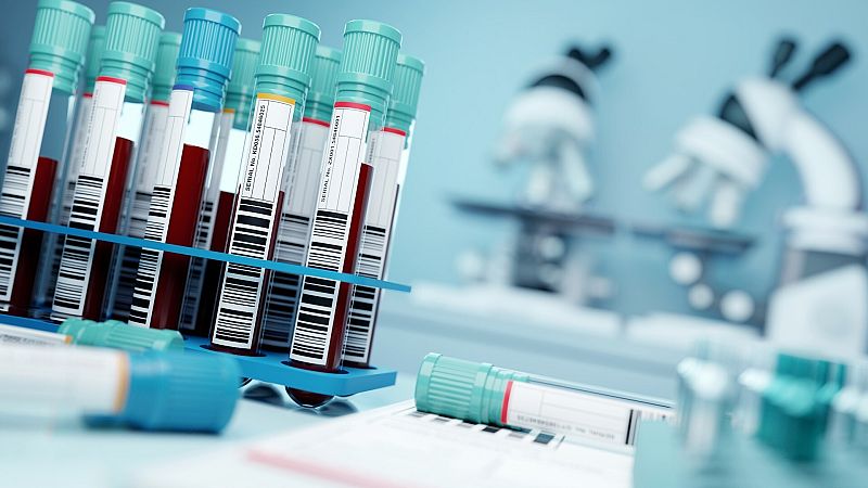 Una paciente logra controlar el VIH durante más de 15 años sin medicación: "Su sistema inmunitario es capaz de arrinconarlo"