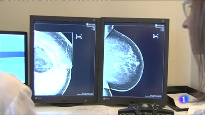 L'Informatiu - Un diagnòstic ràpid és clau per actuar contra el càncer de mama