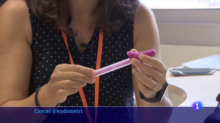 L'Informatiu - Un test semblant a un tampó detecta el 90 % dels càncers d'endometri