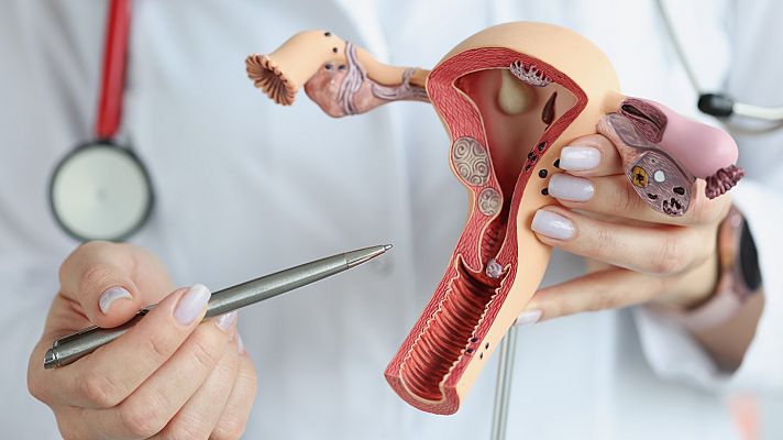 Telediario 1 - Diseñan un test para detectar el cáncer de endometrio desde casa