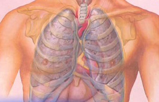 La mañana - Problemas respiratorios