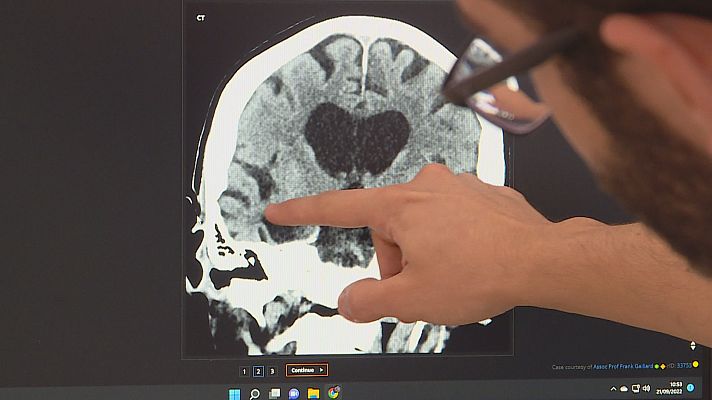 Noticias Andalucía - Día Mundial del Alzheimer