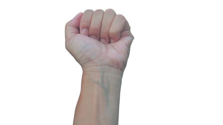 ¿Por qué vemos las venas azules si la sangre es roja?