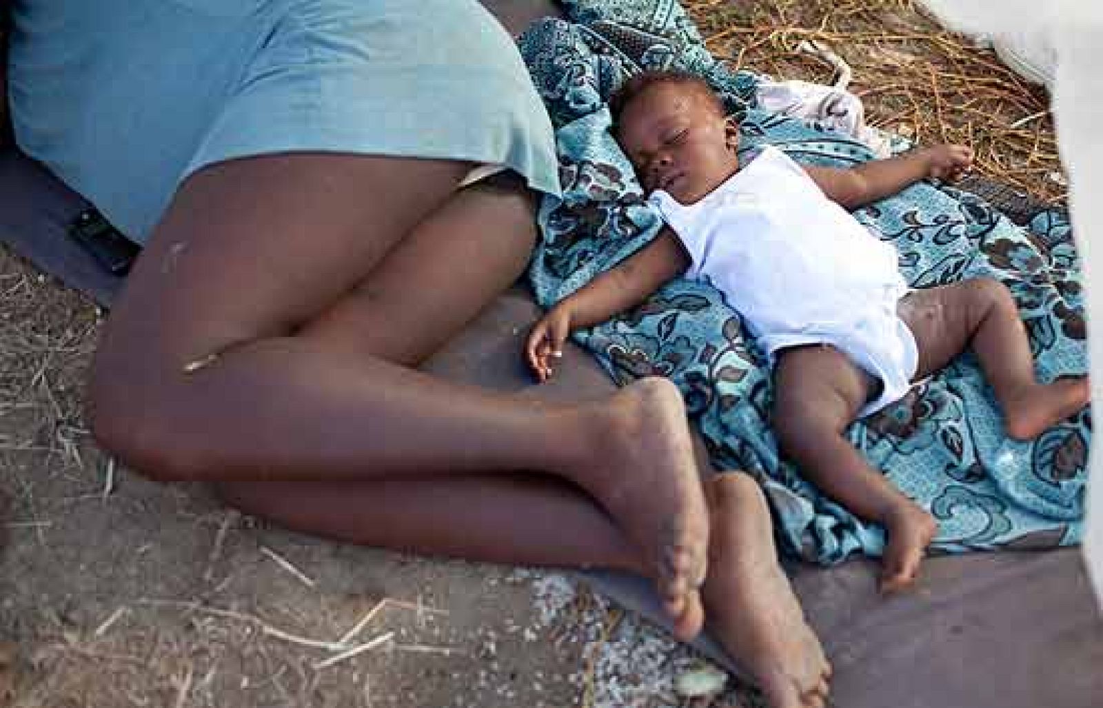 Las medidas de higiene en los hospitales de Haití son tan precarias que muchas fracturas abiertas terminan en amputaciones al sufrir infecciones. Los médicos voluntarios aseguran que nunca han vivido una situación tan extrema.