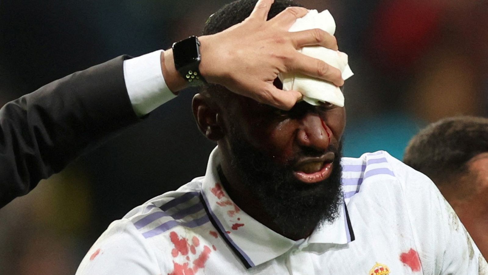 Rudiger y Courtois, dudas para el Clásico | Ver