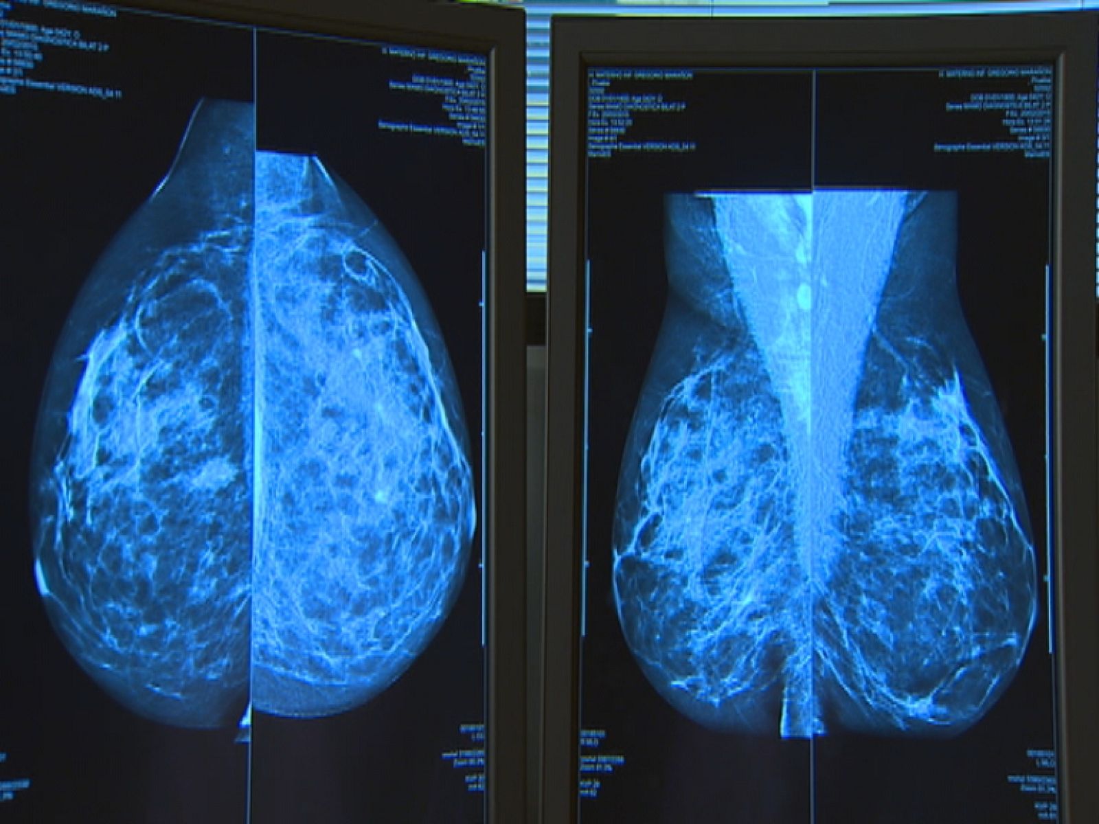 Día Internacional Cáncer de Mama - Ver ahora