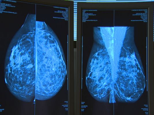 Noticias Andalucía - Día Internacional Cáncer de Mama