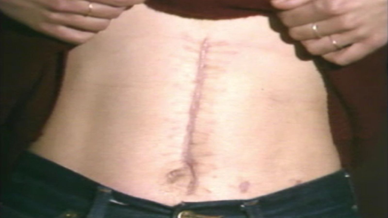 Arxiu TVE Catalunya - Centre d'acolida per a dones maltractades