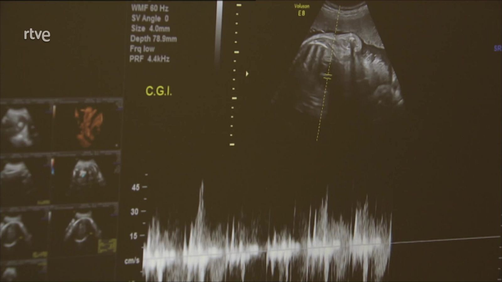 Telediario - 15 horas - 14/01/23 - Lengua de signos - ver ahora
