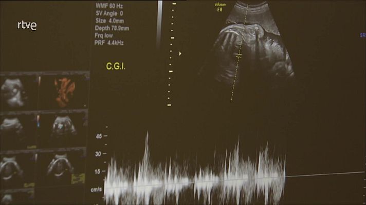 Telediario en lengua de signos - Telediario - 15 horas - 14/01/23 - Lengua de signos