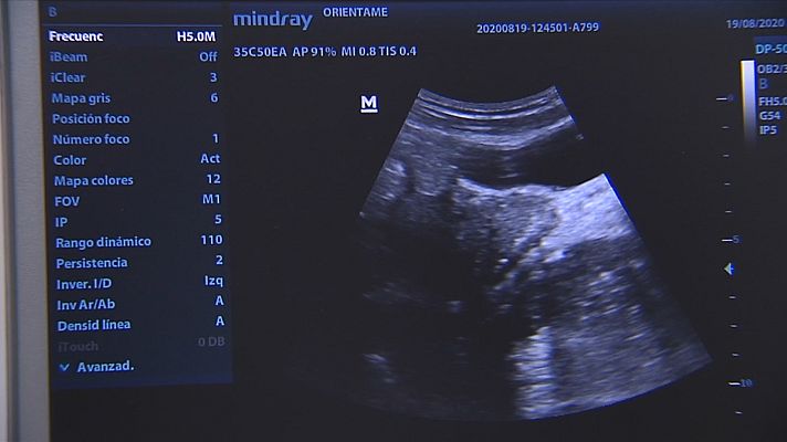 Noticias Andalucía - Polémica aborto