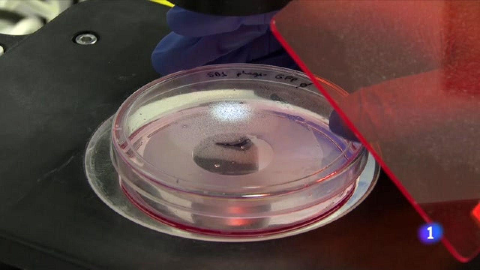 Esperança per als malalts de càncer de pàncrees