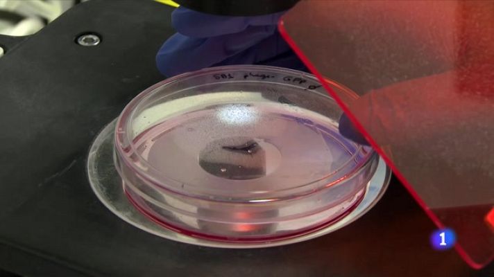 L'Informatiu - Esperança per als malalts de càncer de pàncrees