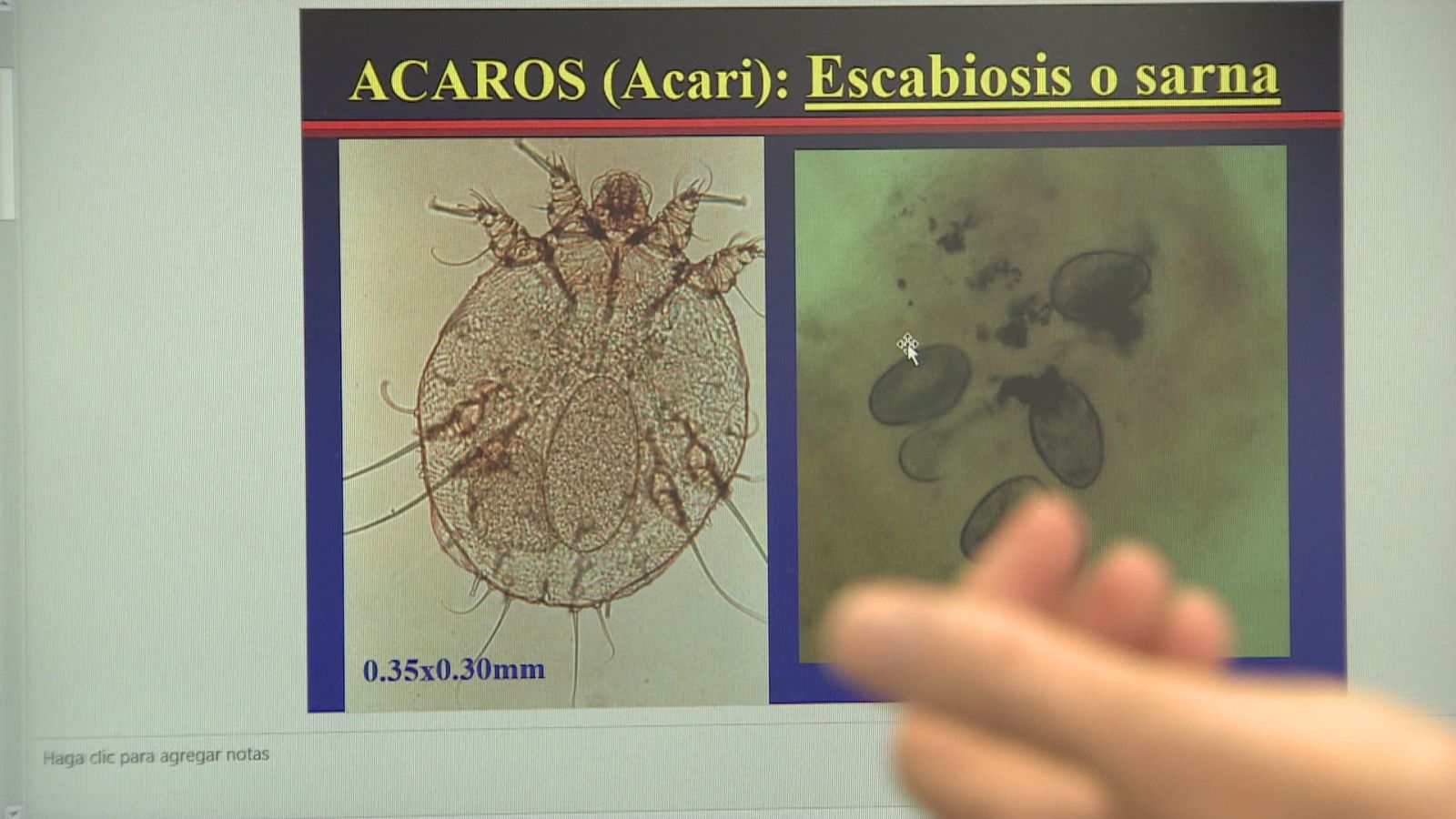 Recomendaciones y consejos ante los brotes de sarna