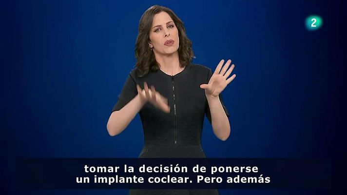 En lengua de signos - Libro blanco sobre implantes cocleares en adultos y ancianos