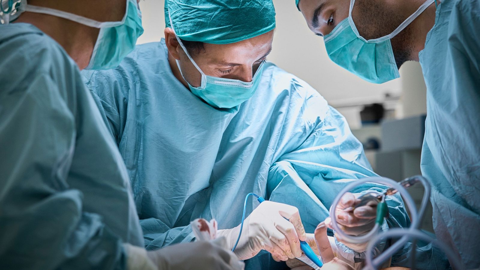 Cirugías extremas: de cambiarse el color de los ojos a parecerse a personajes de cómics