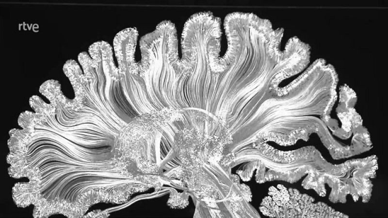 Cerebro(s). El legado de Santiago Ramón y Cajal