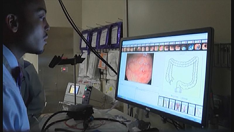 La detecció primerenca és clau per a superar un càncer de còlon