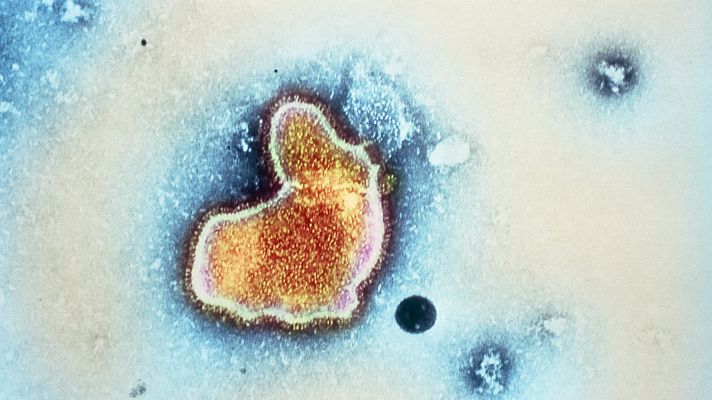 Telediario 1 - Las CC.AA. debaten qué cobertura darle a un medicamento contra la bronquiolitis