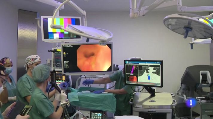 L'Informatiu - Tècnica pionera per delimitar els nòduls del càncer de pulmó