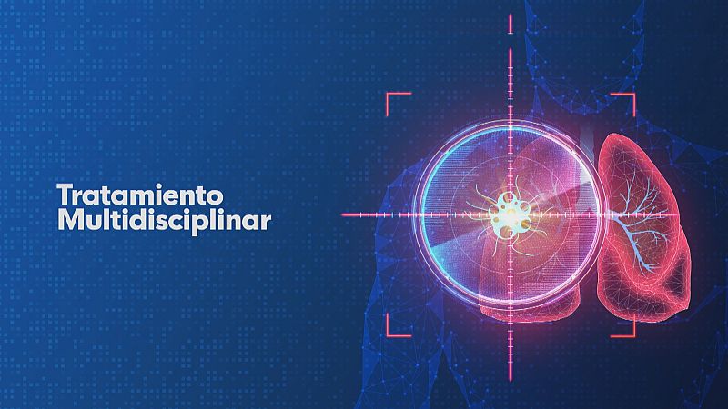 Cuidados para los pacientes con cáncer - Ver ahora