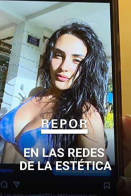 Repor - En las redes de la estética