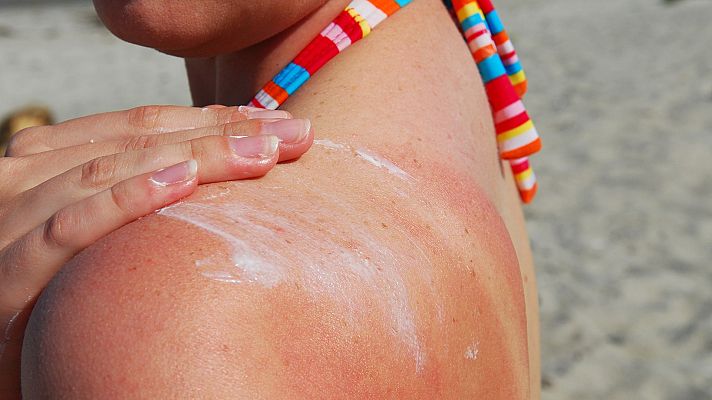 Hablando claro - Consejos para exponerte al sol de manera sana y segura este verano