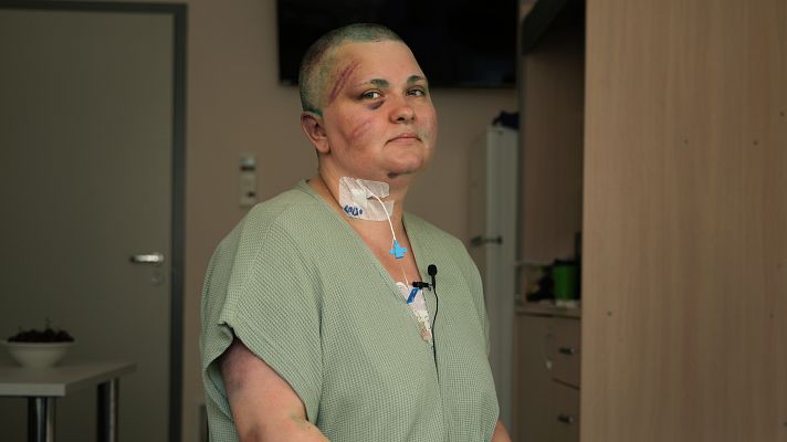 Telediario 1 - El ataque a la periodista Elena Milashina evidencia el cerco a la prensa crítica rusa