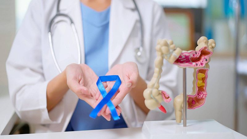 Cáncer de colon en personas jóvenes, ¿por qué sucede? - Saber vivir | Ver