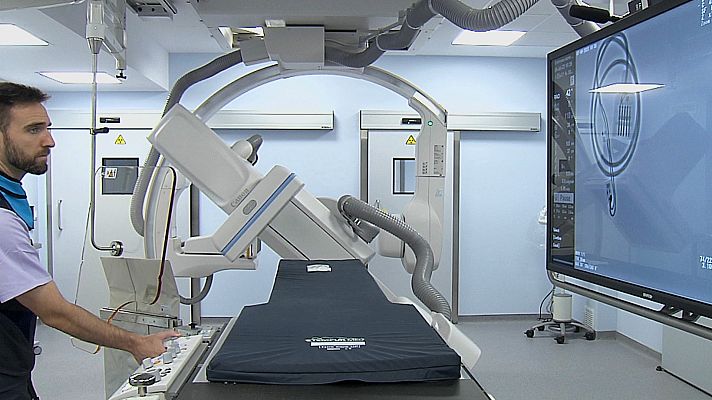 L'informatiu - Comunitat Valenciana - Un nou aparell de rajos X permet detectar millor els ictus