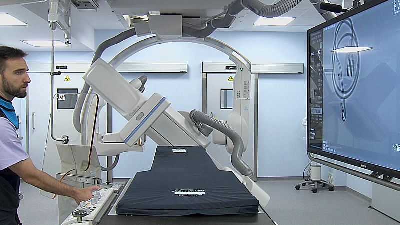 Un nou aparell de rajos X permet detectar millor els ictus