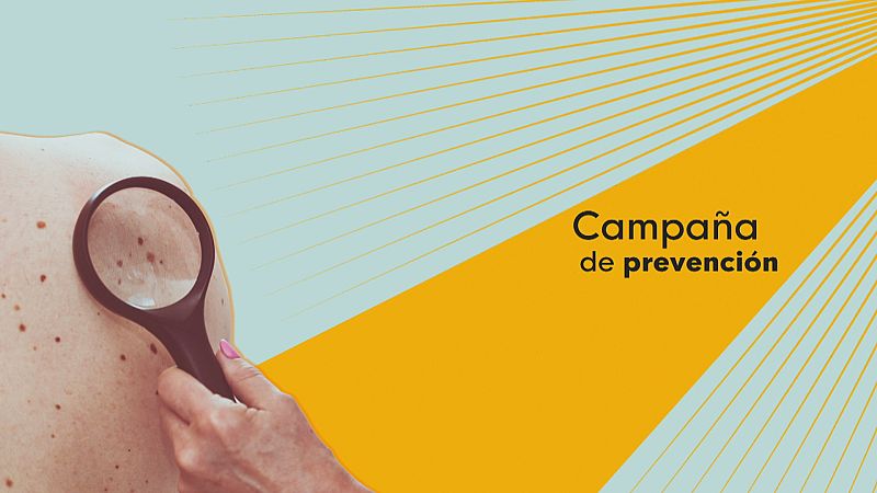 Campaña contra el cáncer de piel - Ver ahora