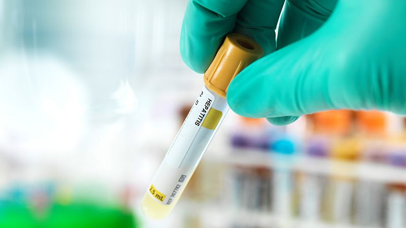 Objetivo: erradicar la hepatitis de aquí a 2030