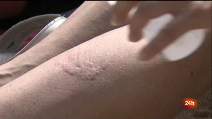 L'Informatiu - Aprendre a conviure amb les meduses