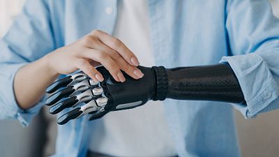 Implantes tecnolgicos: los avances de la medicina