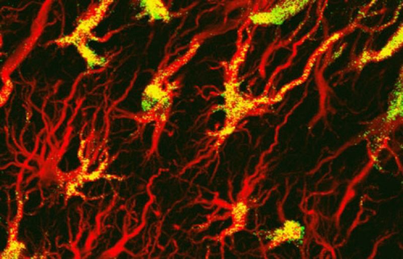Informe Semanal: Viaje al interior del cerebro