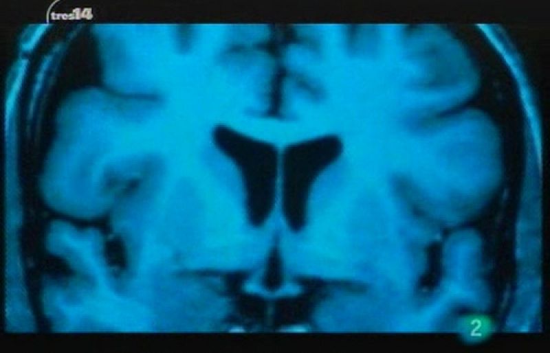 tres14 - En una gota de sangre