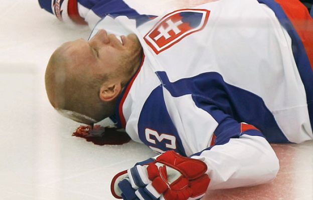  - Bartecko, el susto de la jornada