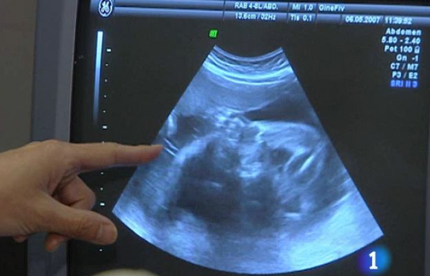  - Vientres de alquiler