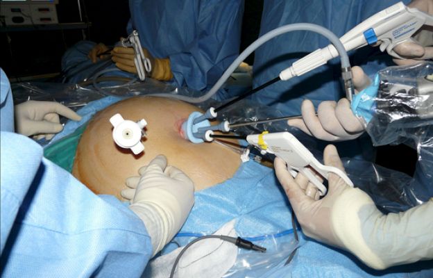 Ciencia y tecnología en Rtve.es - La prevención, la mejor medicina