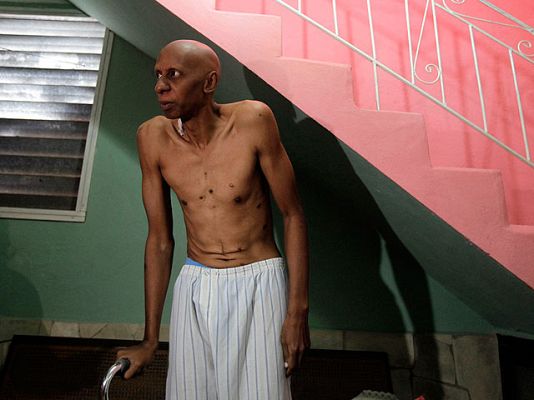  - Fariñas denuncia al régimen cubano