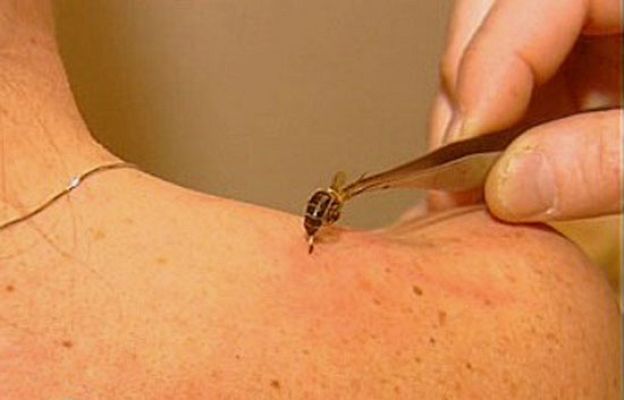 España Directo - Terapia con abejas